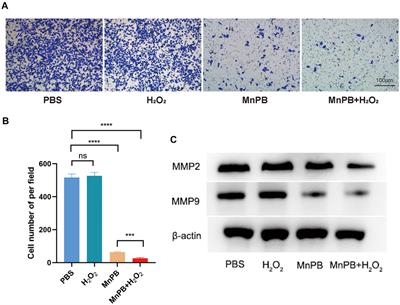 Manganese-based Prussian blue nanoparticles inhibit tumor proliferation and migration via the MAPK pathway in pancreatic cancer